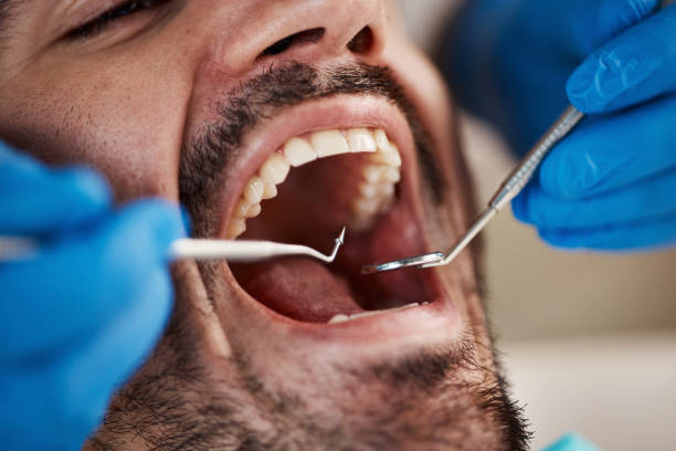 Best Urgent Care for Lost Fillings or Crowns in Hasbrouck Heights, NJ